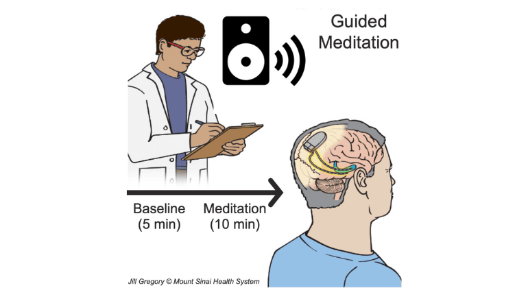 EEG Study Links Mindfulness Meditation to Brain Changes in Emotional Eaters