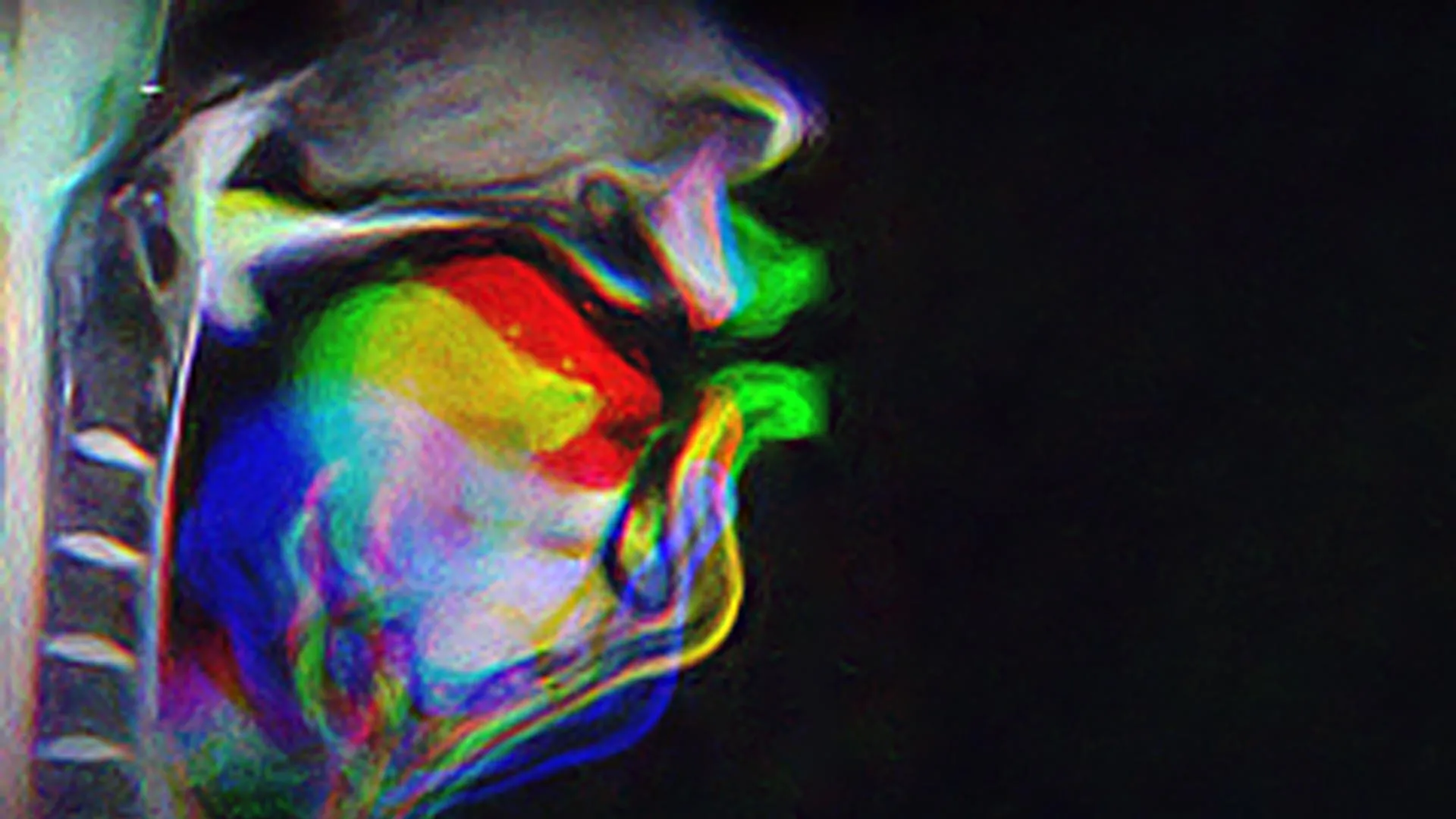 Study finds speech learning depends more on sensory brain regions