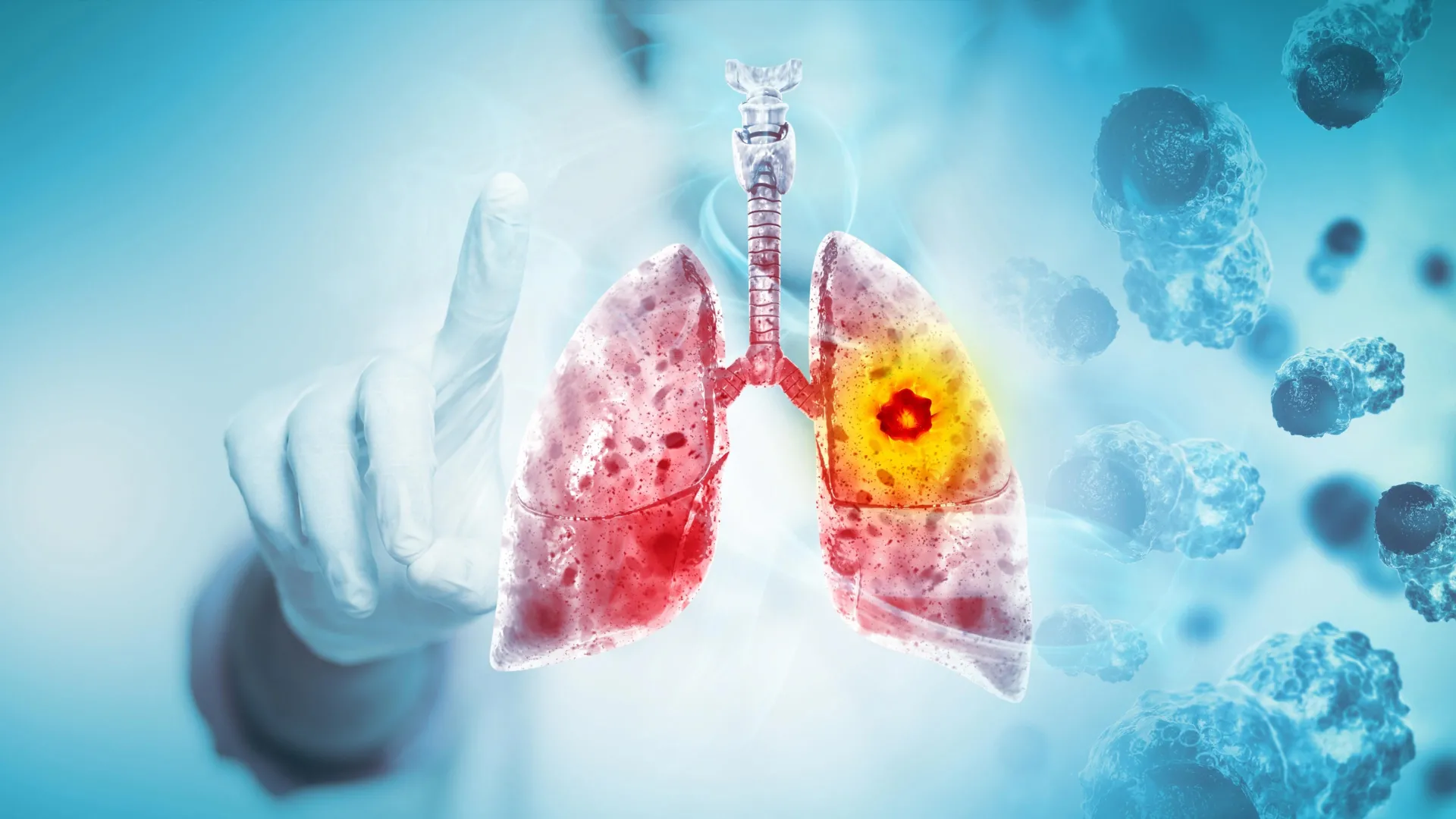 Review links nicotine e-cigarettes to lung and oral cancer