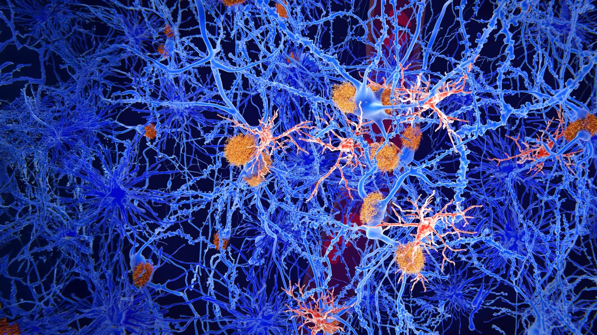 Researchers find molecule that reprograms brain immune cells in Alzheimer’s